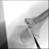 SPORK, NICO - 22.03.1976 - 04.08.2022 - Durchleuchtung UN OP - 10:59:22